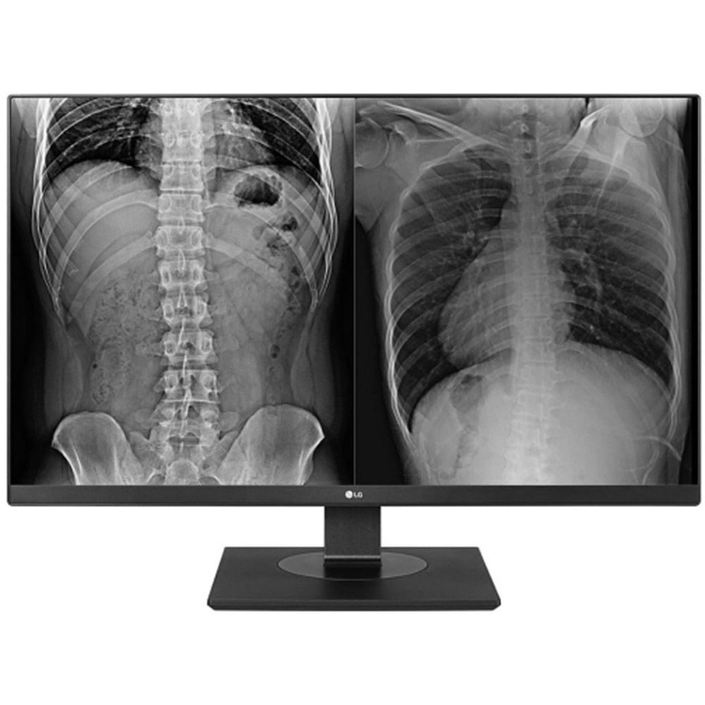 Monitor LED LG 27HJ713C-B, 27inch, 3840x2160, 5ms, Negru, 27HJ713C-B.AEE